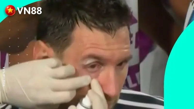 Bác sĩ chăm sóc mí mắt Messi